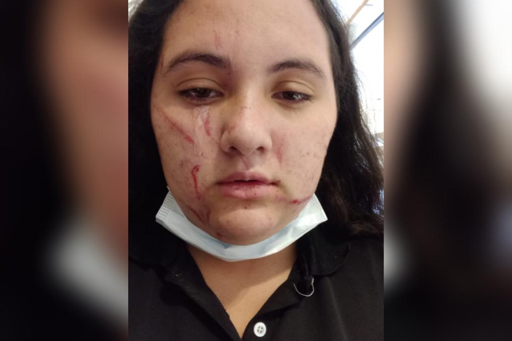 Trabajadora de Doggis denunció brutal agresión: Habría alertado condiciones insalubres en local
