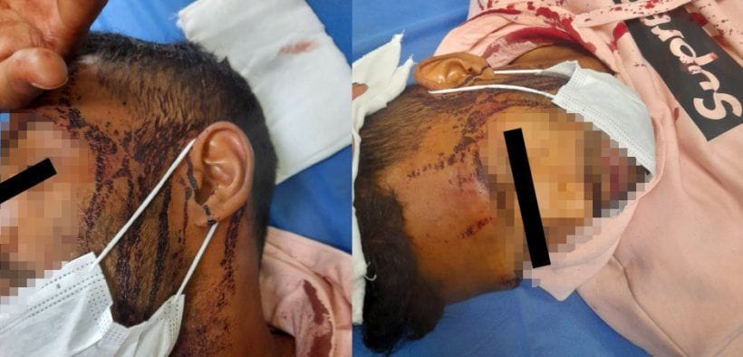Pareja gay fue brutalmente agredida con palos y pistola en Santiago