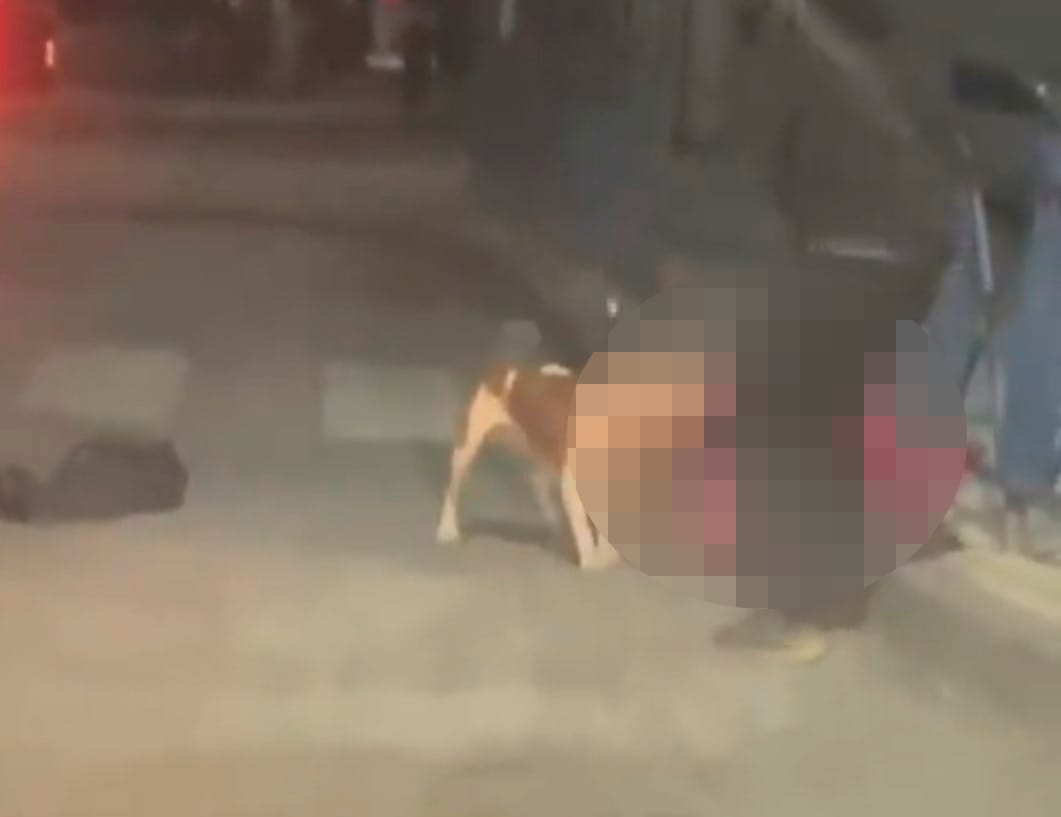 Perros pitbull atacan salvajemente a mujer en Talcahuano