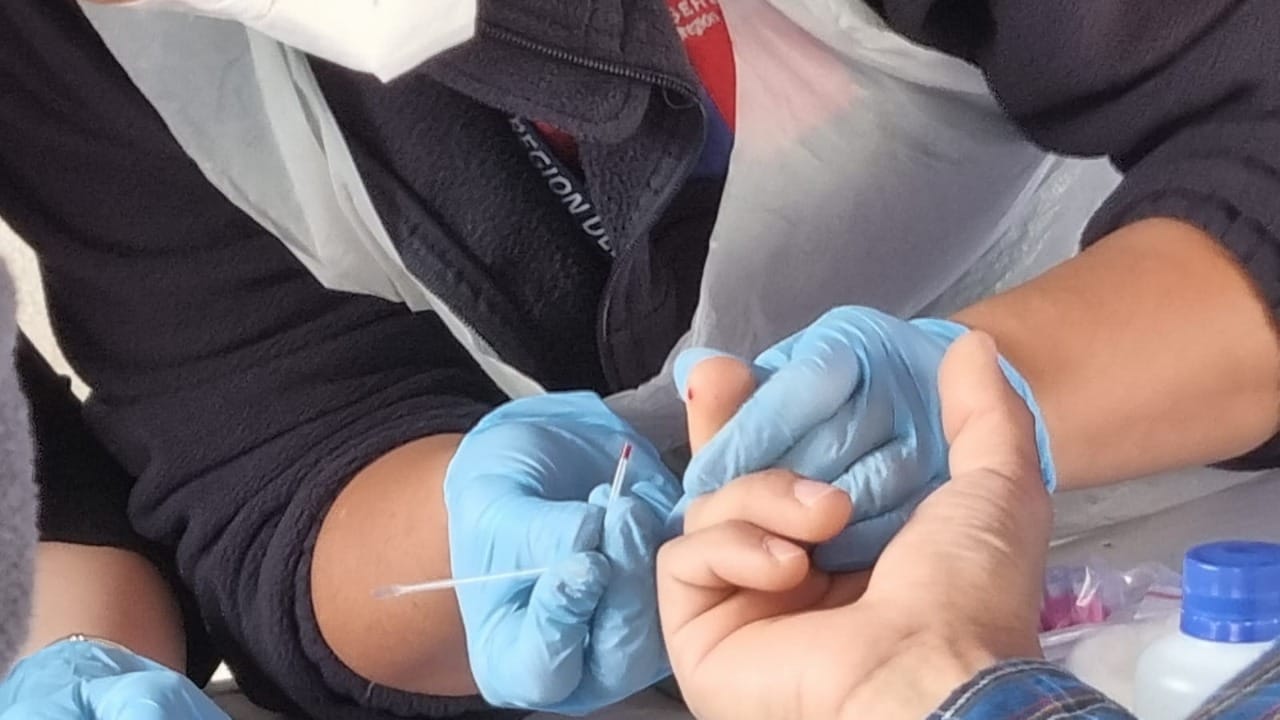 Realizarán operativo gratuito de test rápidos de VIH en Concepción