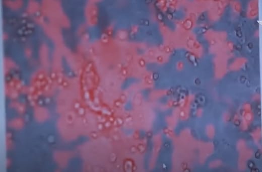 España emite alerta sanitaria frente a ocho posibles casos de “viruela del mono”