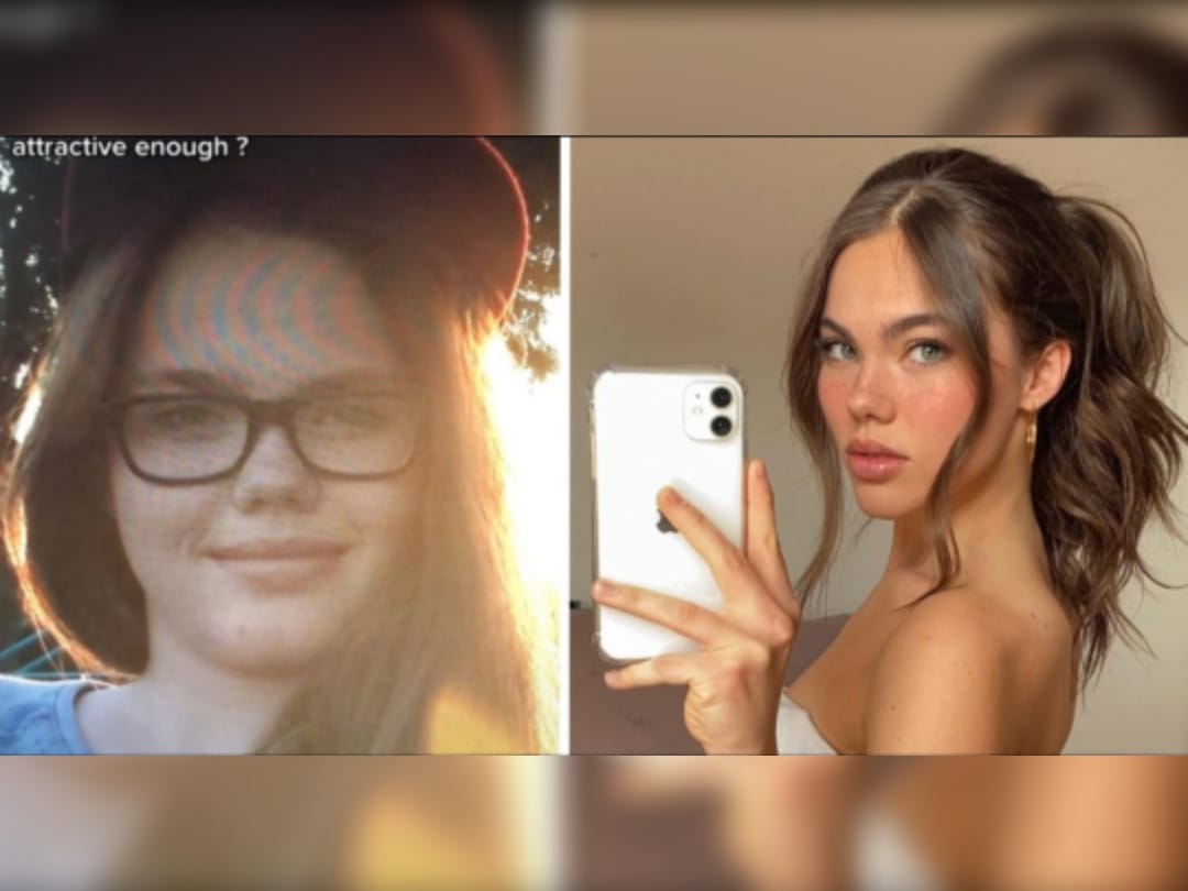 Se vengó: Mujer dejada por su pololo por “no ser linda” creció y ahora es modelo internacional