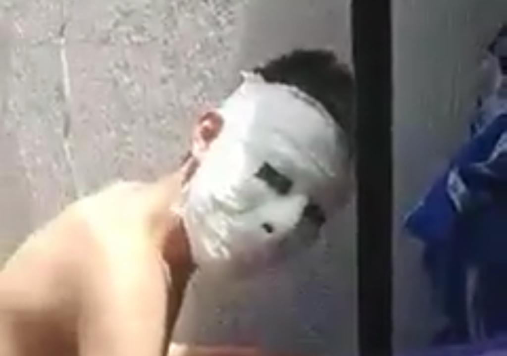 “Voy a demandar a esa maestra”: Joven terminó con máscara de yeso pegada a su cara y se volvió viral