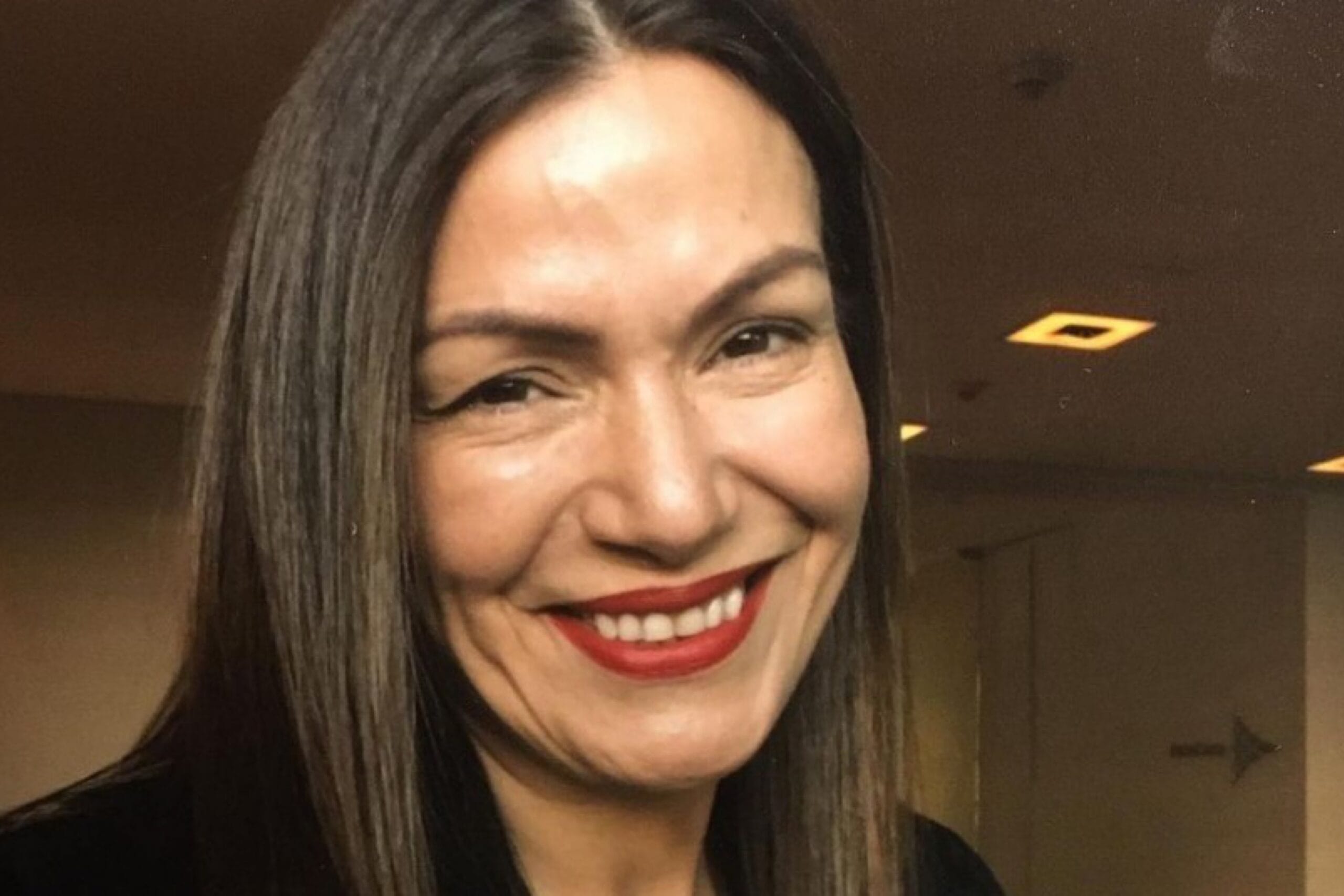 “Cinco meses con una herida abierta en mi abdomen”: Solange Lackington contó el complejo momento de salud que enfrentó