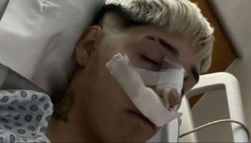Pailita se sometió a cirugía en el rostro y mostró el radical cambio que dejó en su nariz