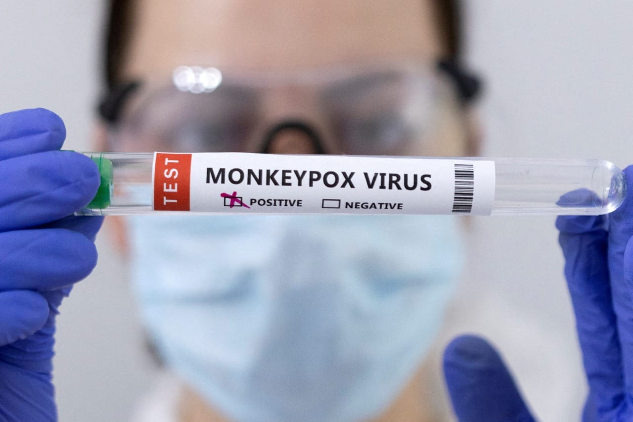 Emiten alerta por nueva cepa de Viruela del Mono: Más de 450 personas han fallecido