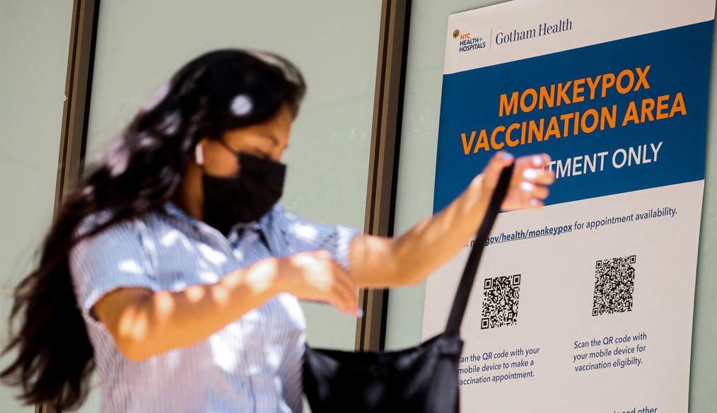 Estudio indica que viruela del mono podría ser mortal para quienes tienen VIH o sistema inmune débil