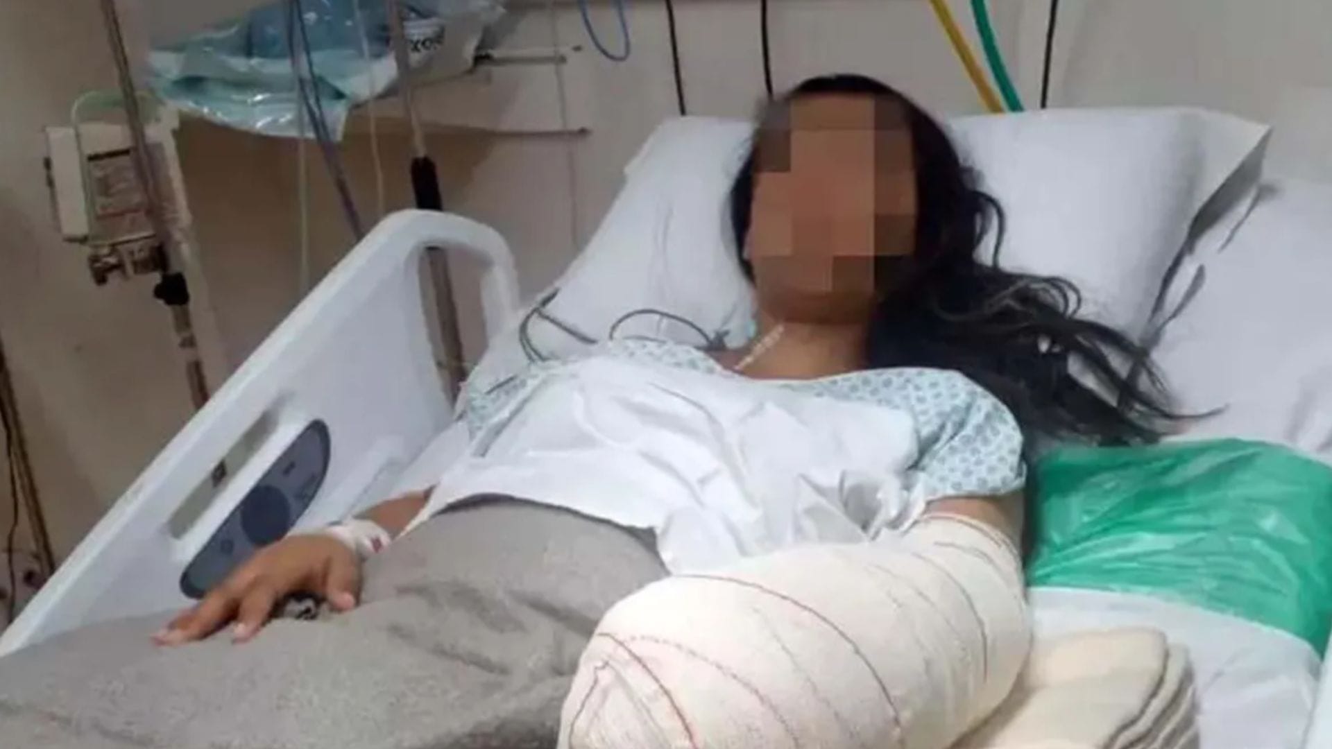 Mujer dio a luz en el hospital y terminó con una mano amputada: Denuncian negligencia médica
