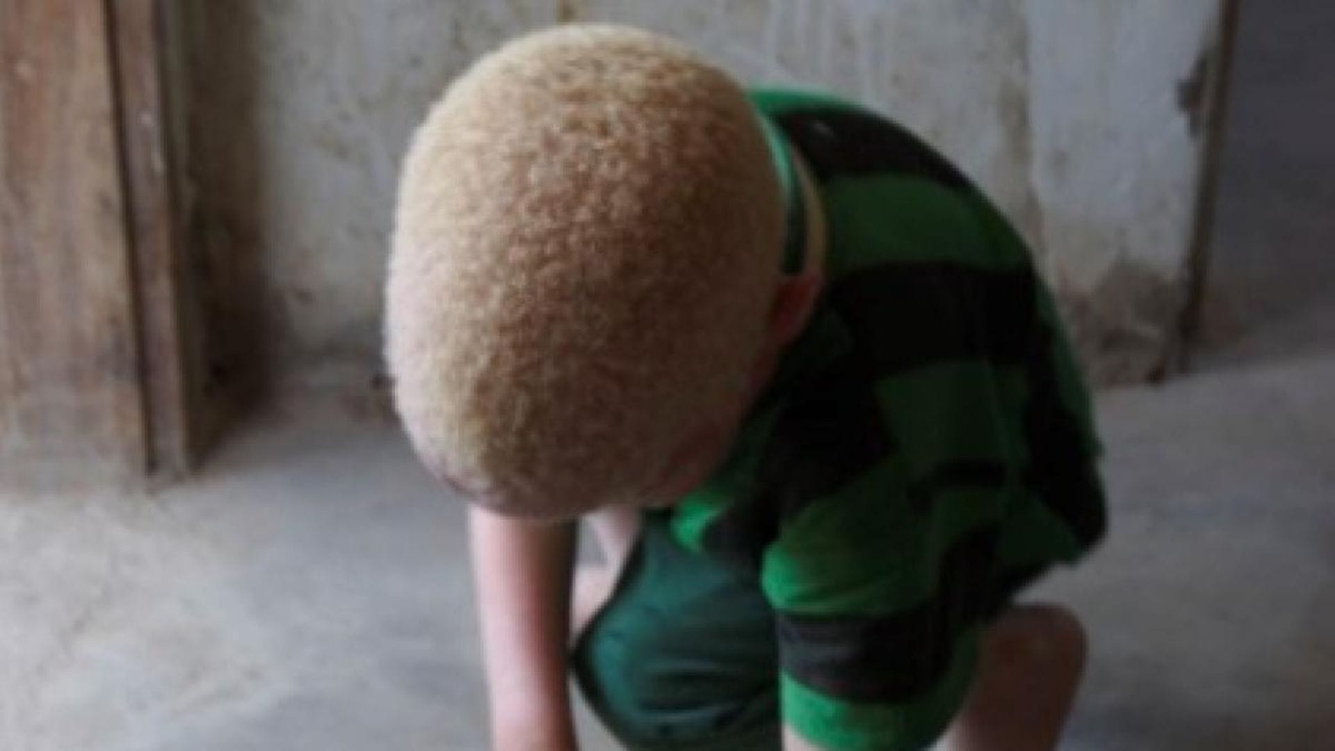 Macabro crimen: Niño albino de cinco años fue decapitado en la República Democrática del Congo
