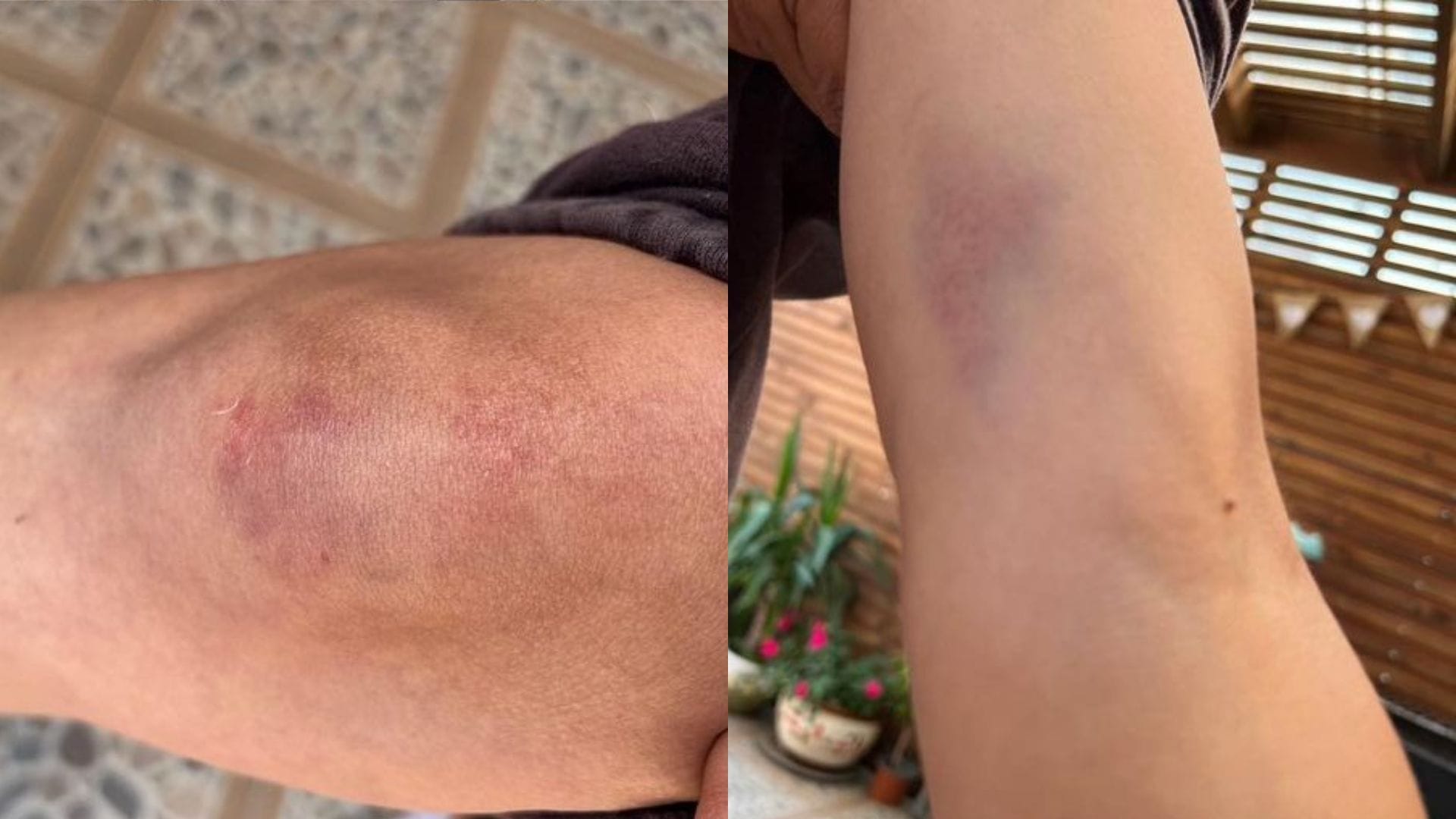 Violenta pelea terminó con mujer agredida en discoteque de Concepción