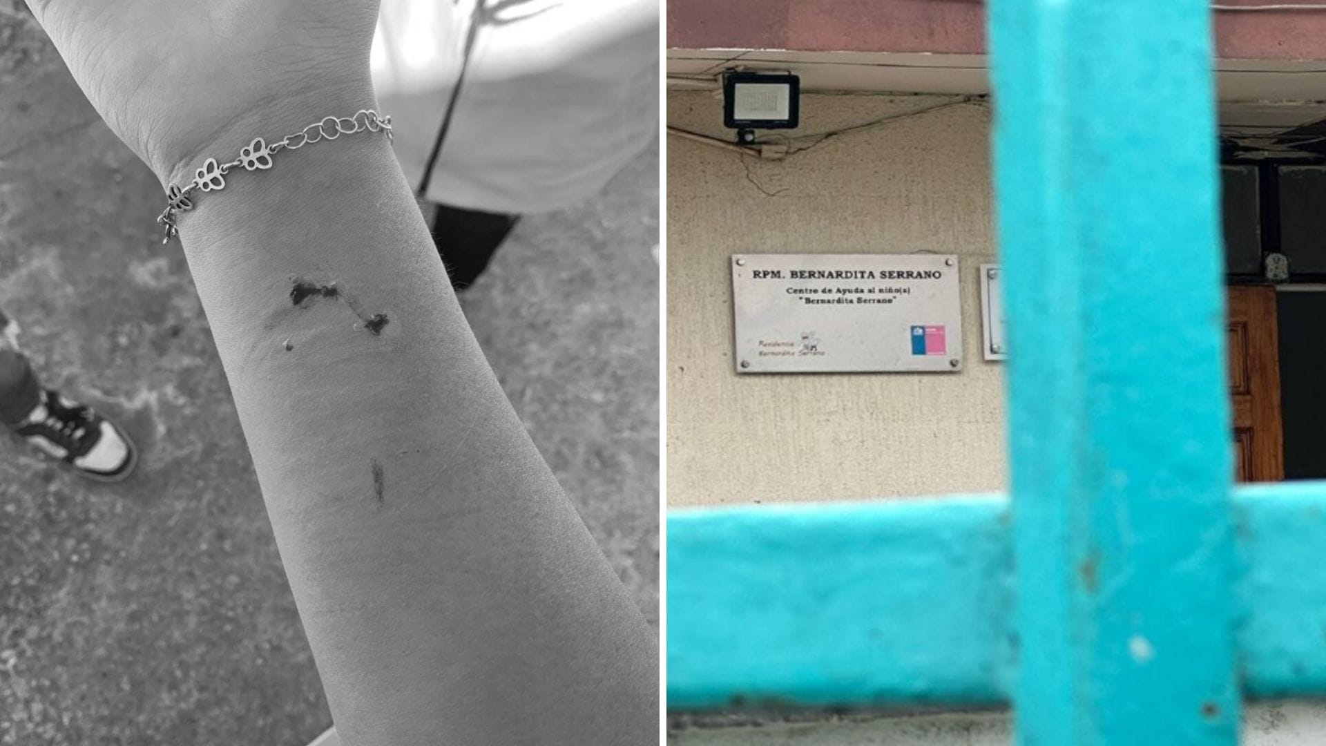 Denuncian que niña víctima de trato degradante en residencia de San Pedro de la Paz sufrió golpiza
