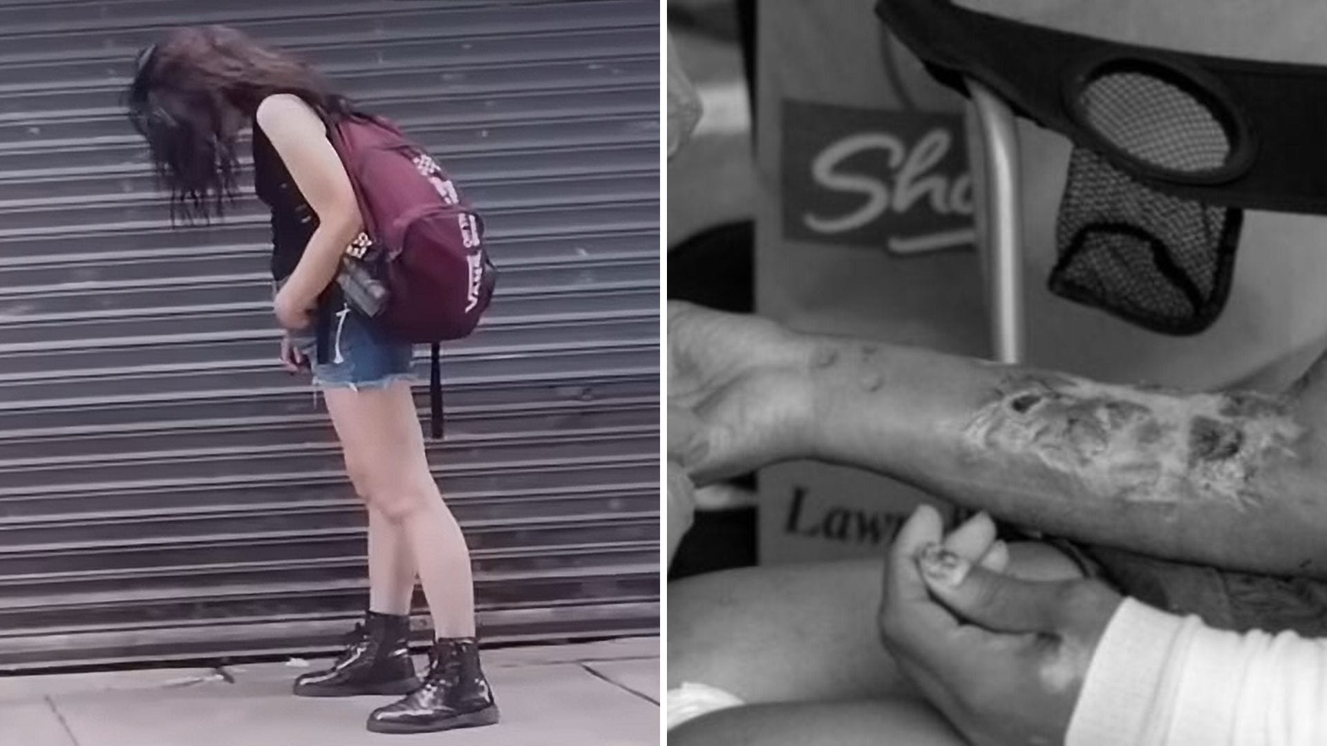Tranq: Qué se sabe de la nueva “droga zombie” que pudre la piel y preocupa por su masificación en Estados Unidos
