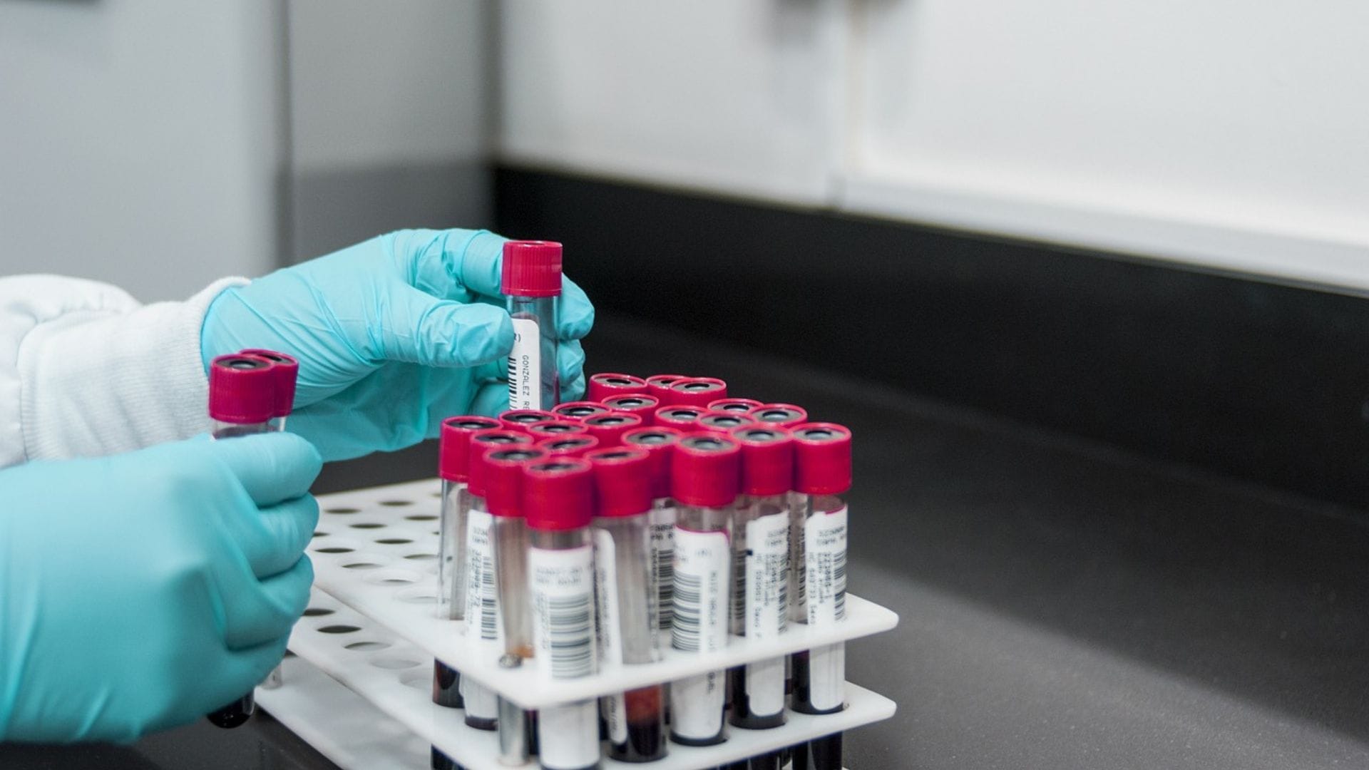 Abren proceso sancionatorio a laboratorio de la Universidad de Concepción: Arriesga millonaria multa