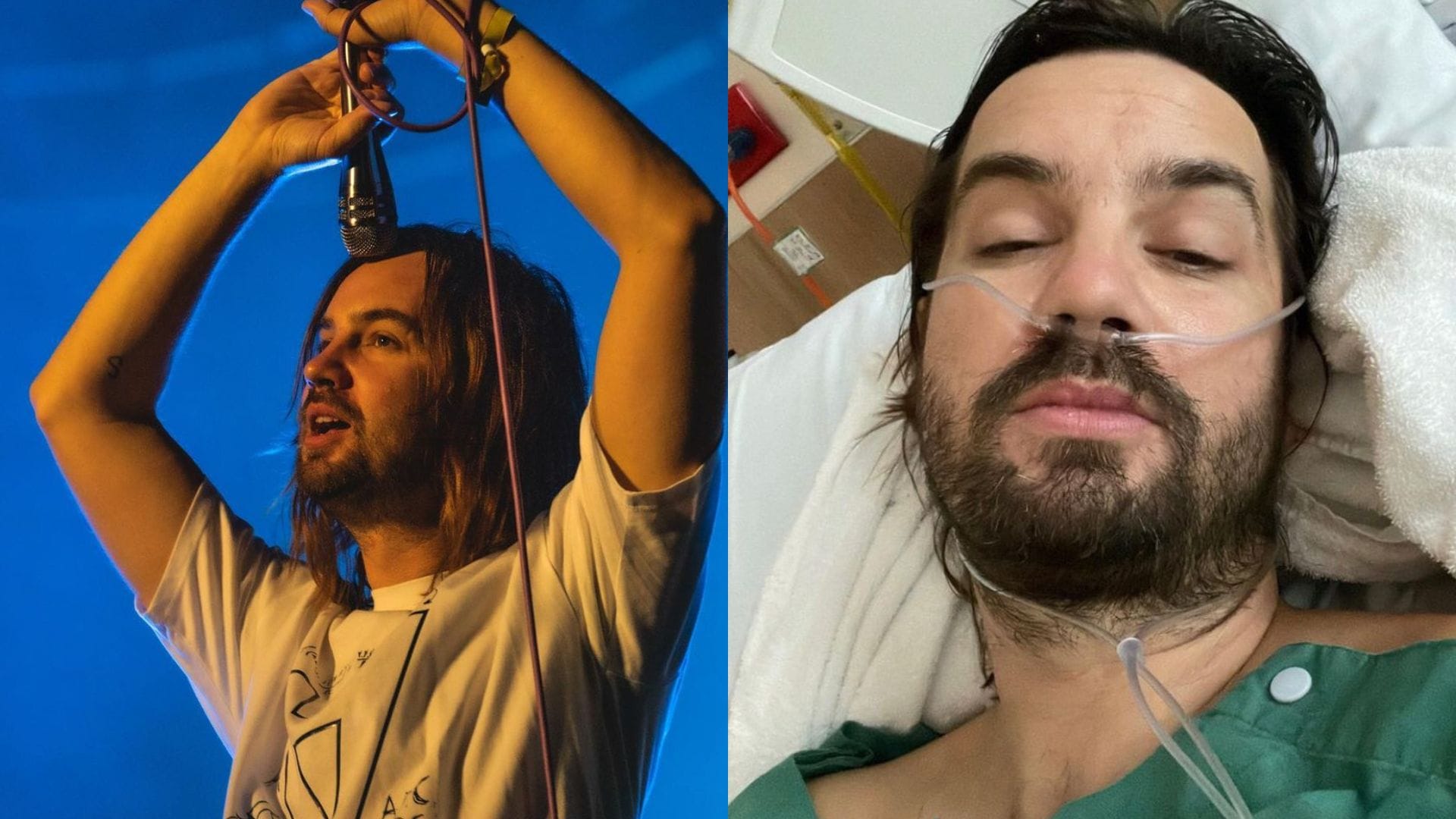 ¿Peligra Tame Impala en Lollapalooza? Líder de la banda se fracturó la cadera