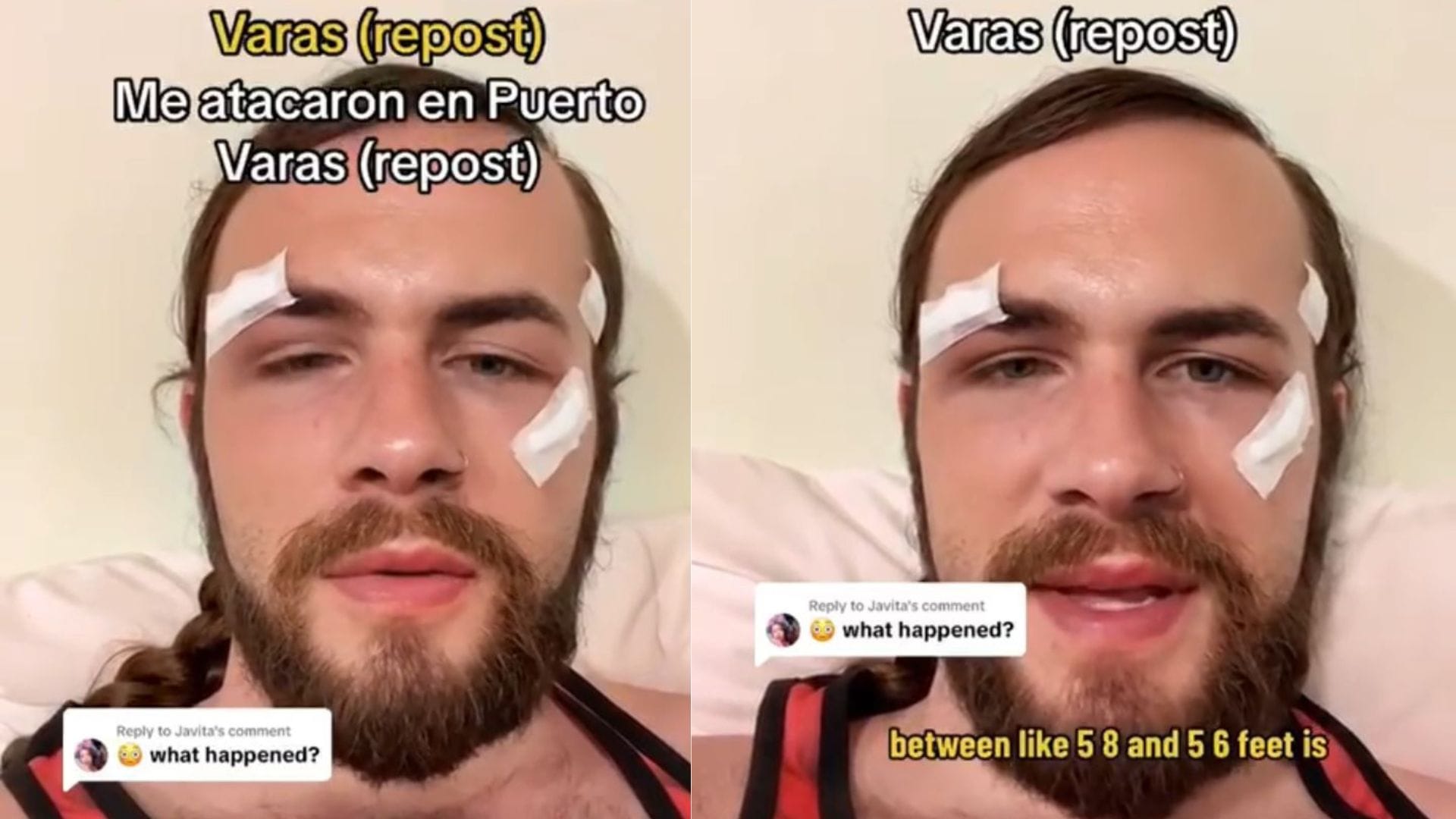 Lo conoció en una app de citas: Turista sufrió violenta agresión en Puerto Varas