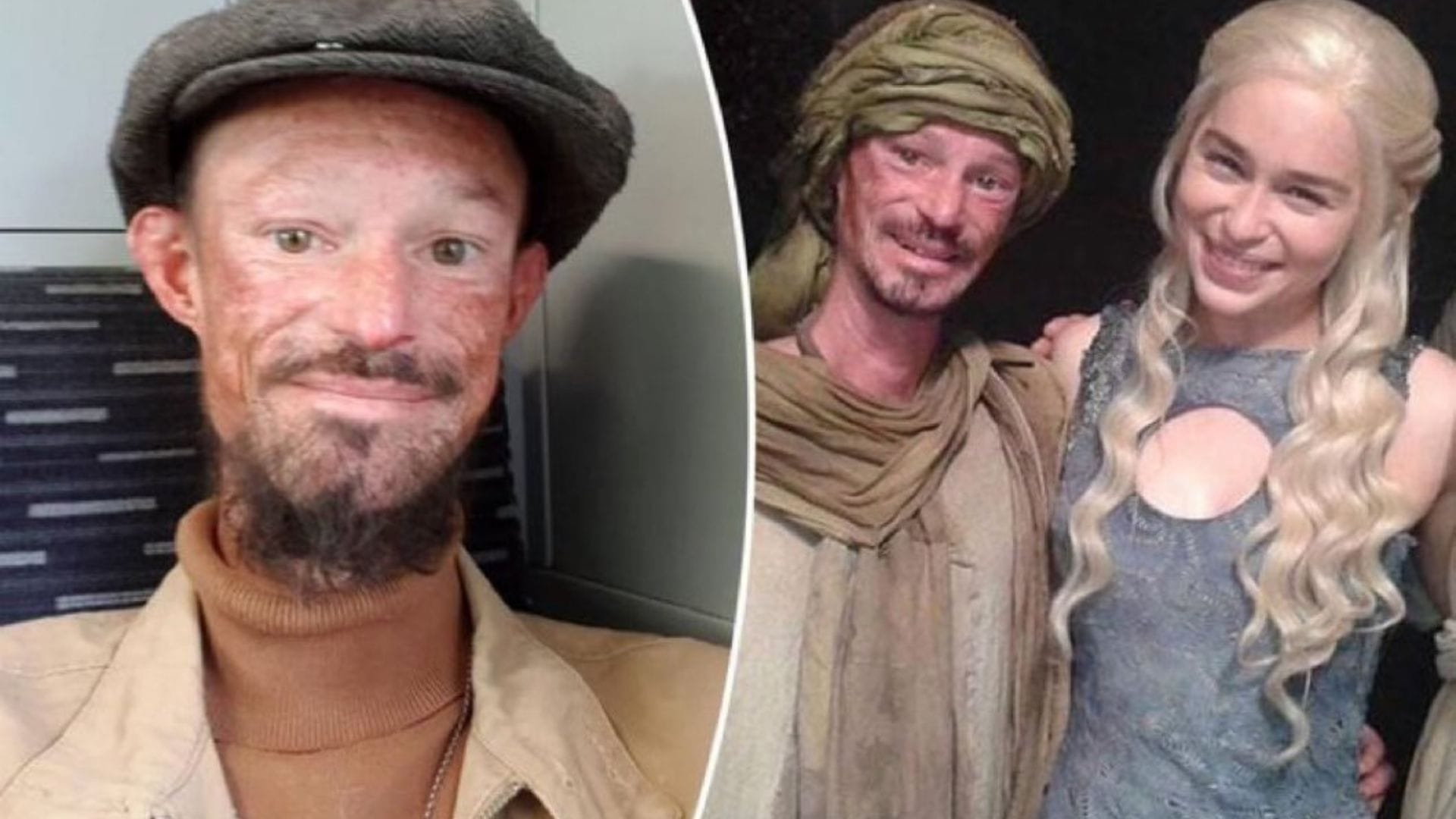 Luto para los fans de “Game of Thrones”: Darren Kent murió tras luchar contra la osteoporosis