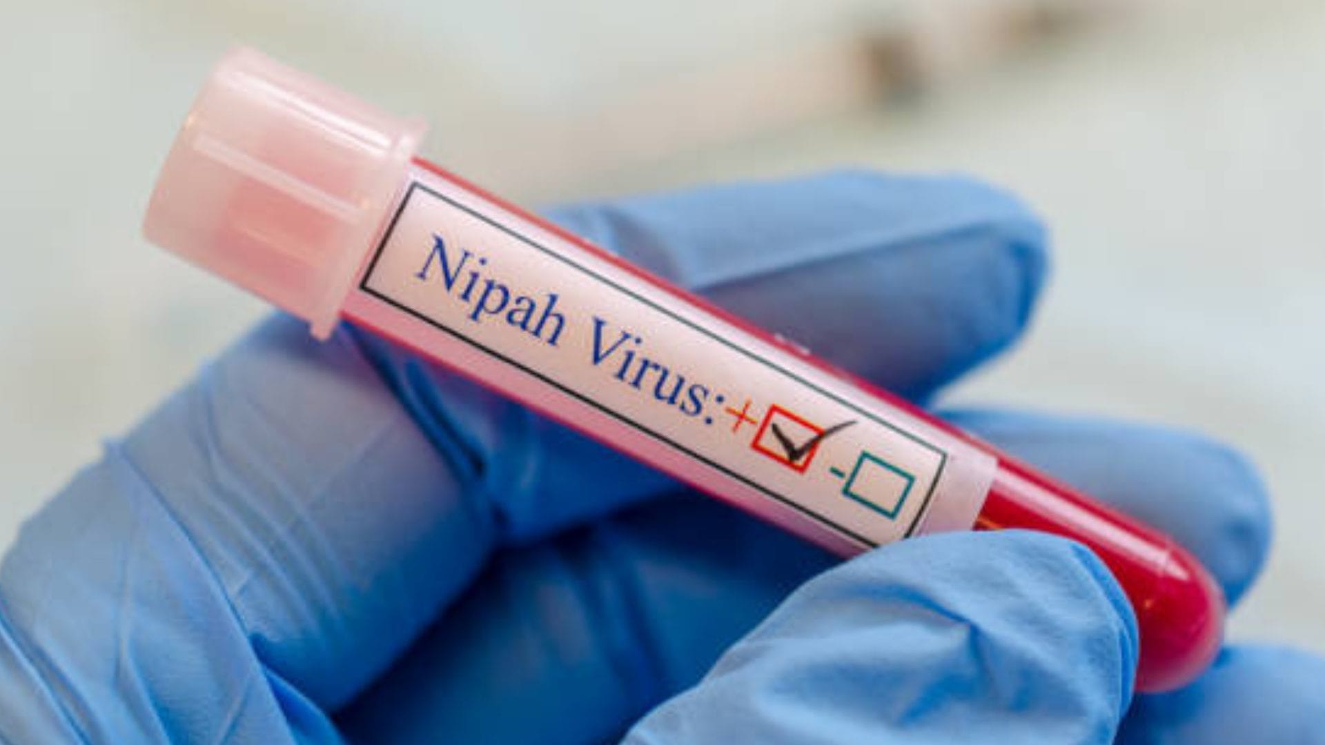 ¿Qué es el virus Nipah?: Explican cuáles son sus síntomas y cómo se transmite