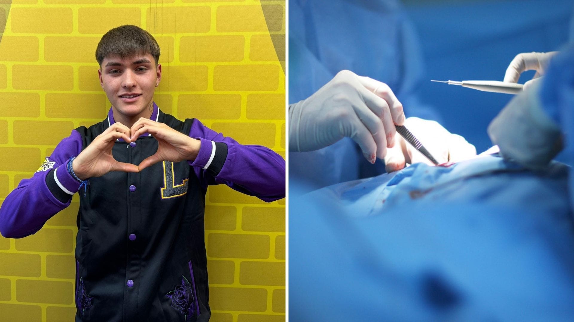 Hans de Gran Hermano se somete a una intervención estética: Mira el antes y el después
