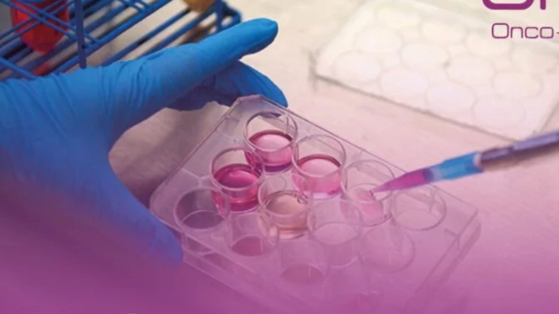 La importancia de conocer los tipos de inmunoterapias contra el cáncer: Su efectividad es distinta