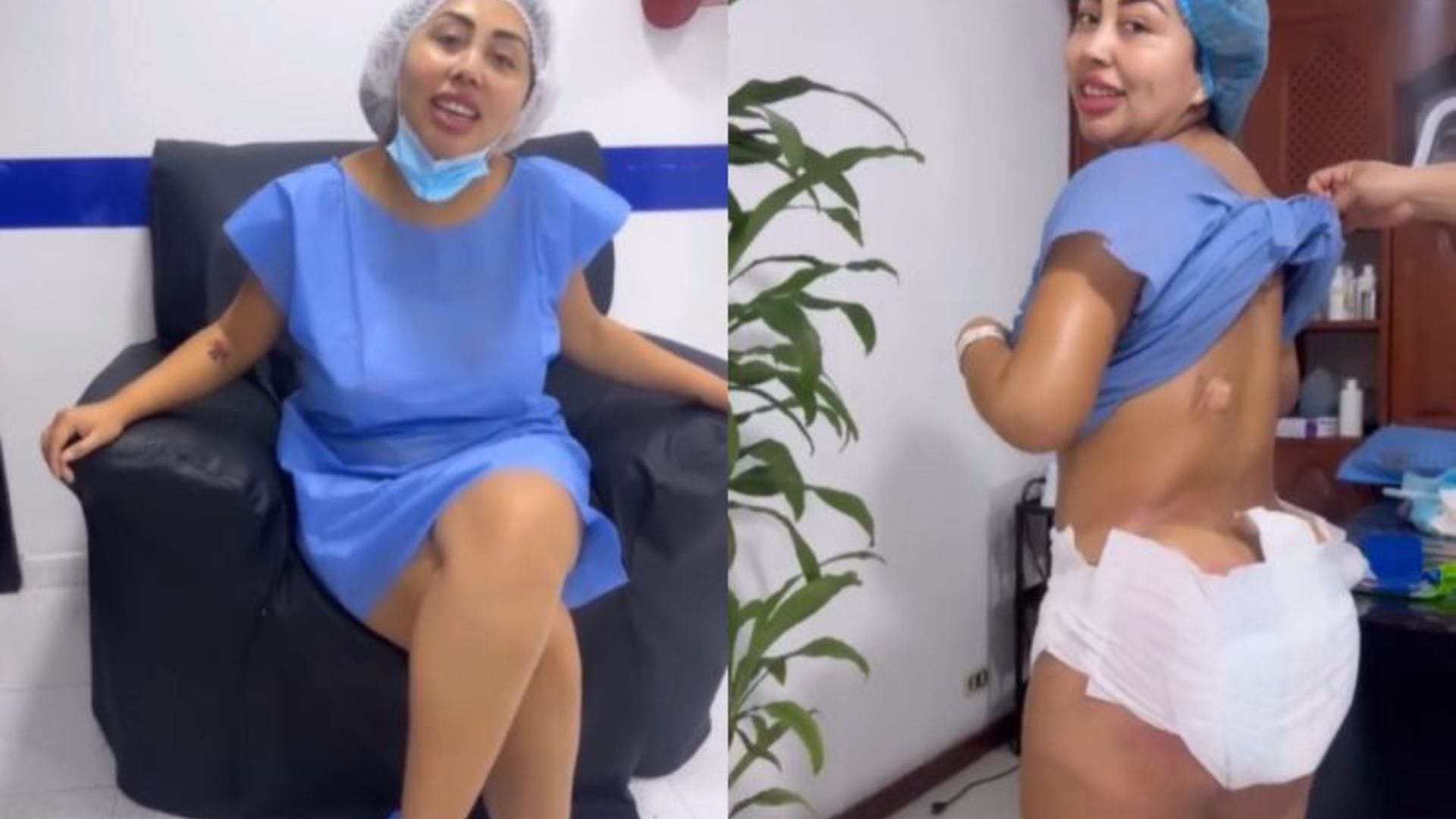 “La vida es una sola”: La nueva cirugía que se realizó Naya Fácil