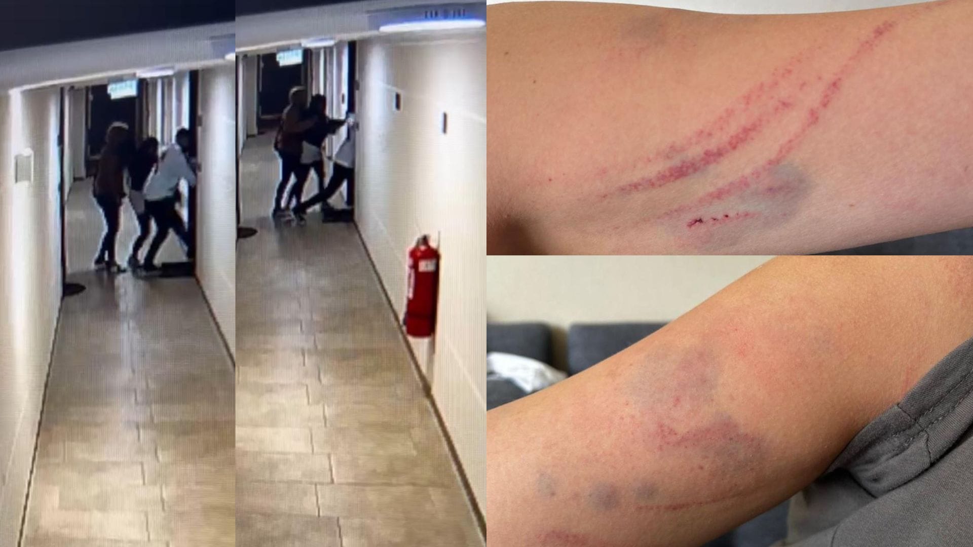 Mujer denuncia brutal episodio de violencia en Concepción: Sujetos habrían entrado a la fuerza a su casa para golpearla