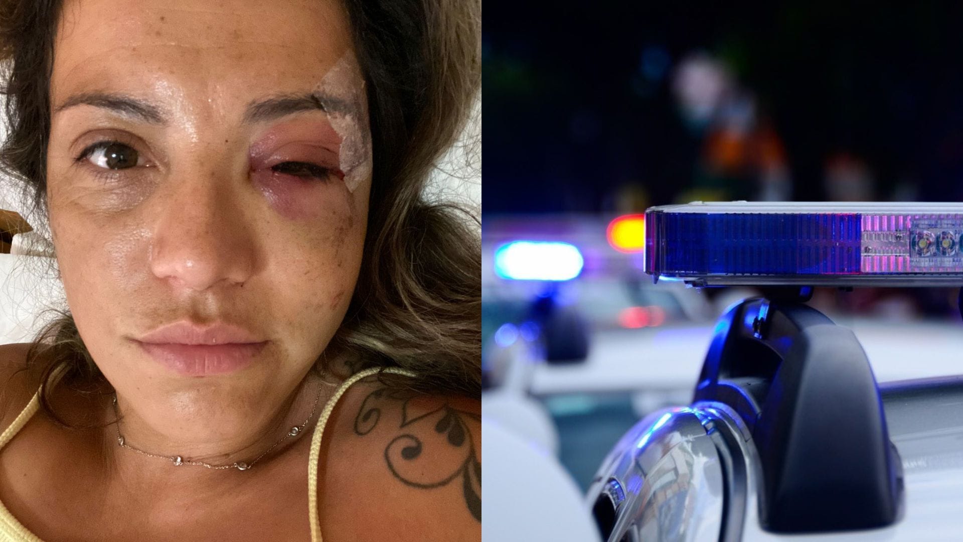 Violento asalto y lanzazo: La dramática experiencia que vivió penquista durante sus vacaciones en Brasil