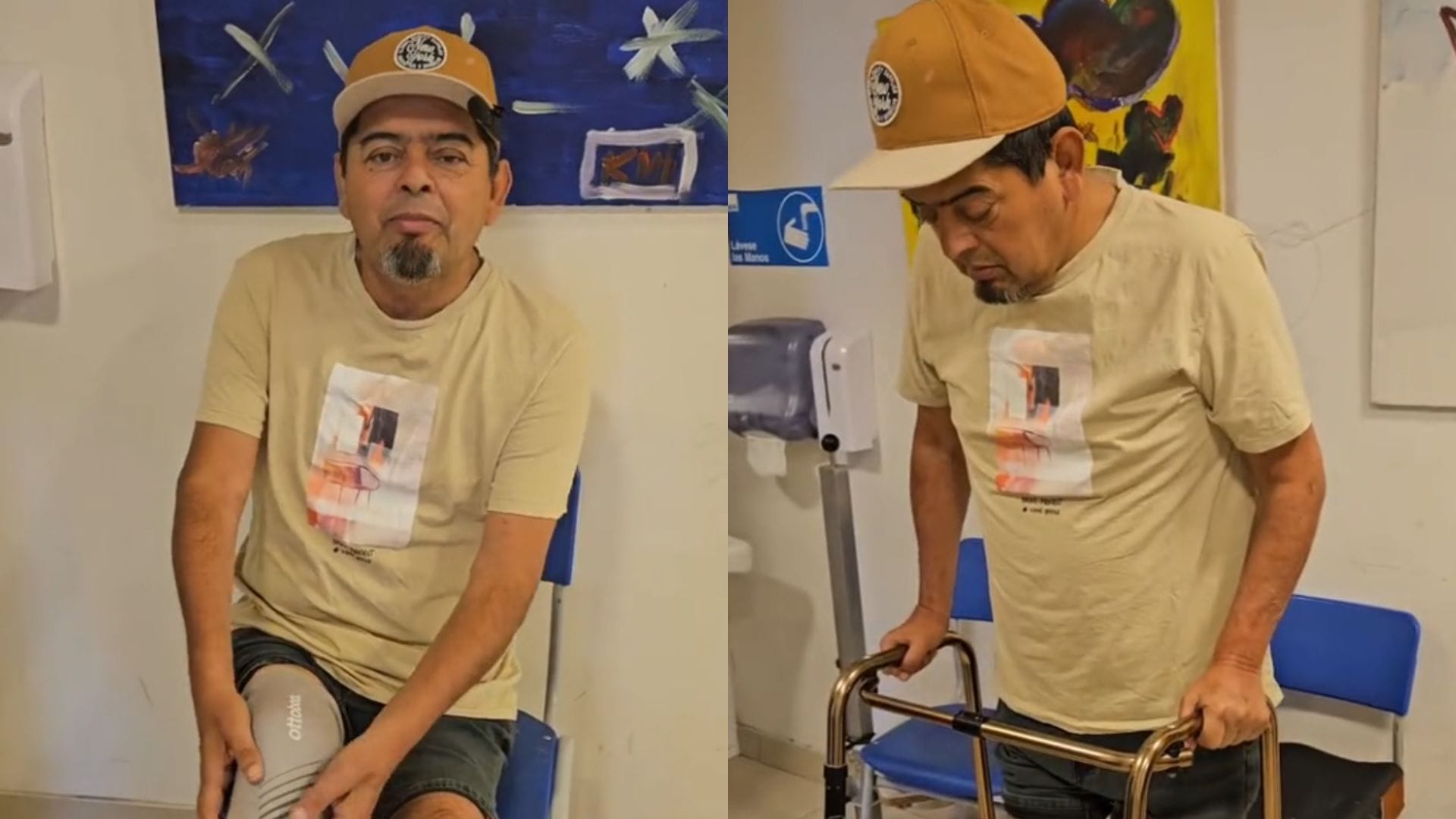 Mauricio Medina reveló avances de su proceso de rehabilitación tras sufrir la amputación de parte de su pierna
