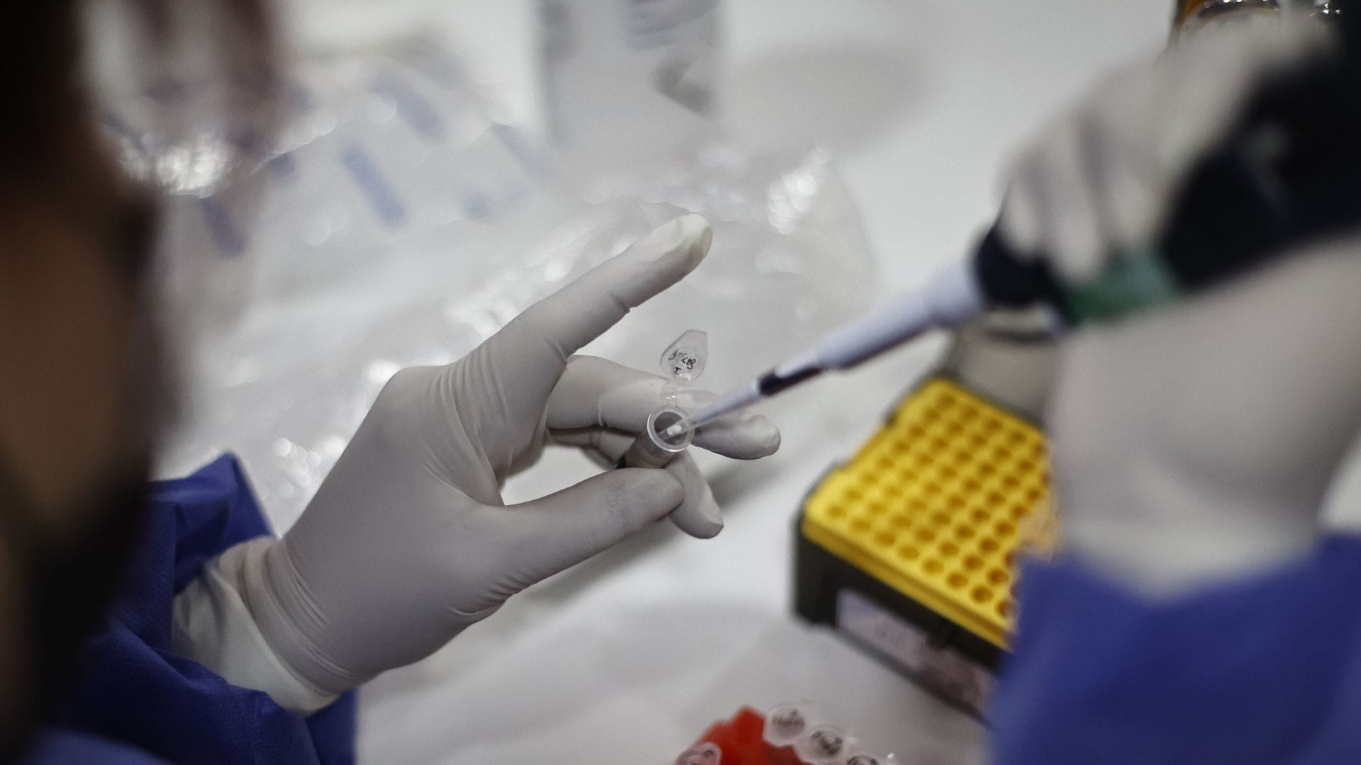 Viruela del Mono: Autoridades sanitarias del Biobío toman medidas ante un eventual brote