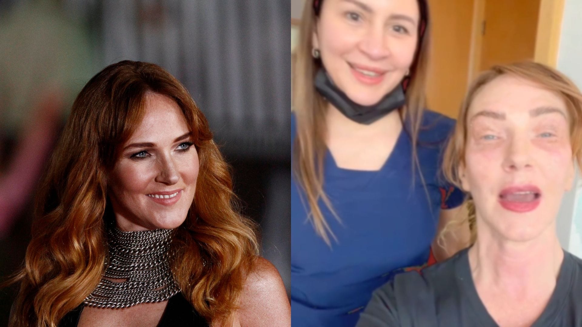 Catalina Pulido muestra el tratamiento estético al que se sometió antes de ingresar a “Palabra de Honor”