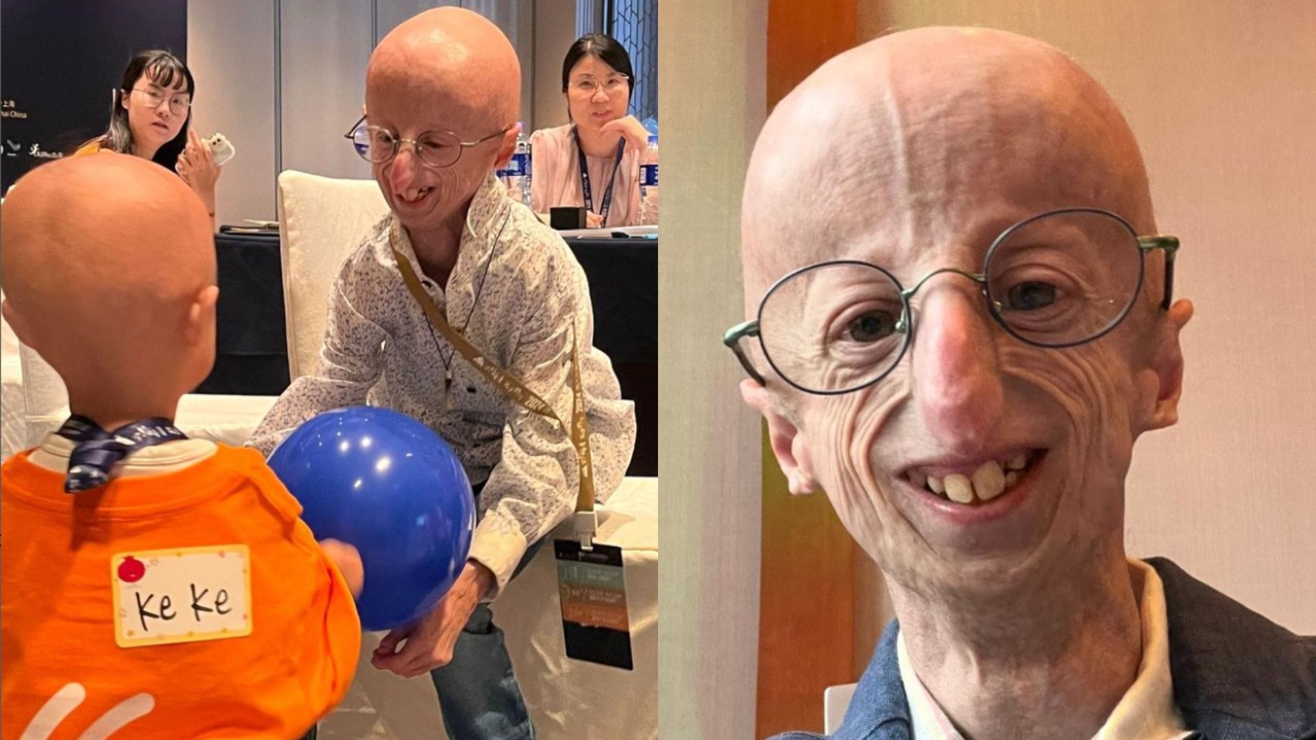 Muere Sammy Basso, activista que luchó por la visibilización de la progeria, a corta edad