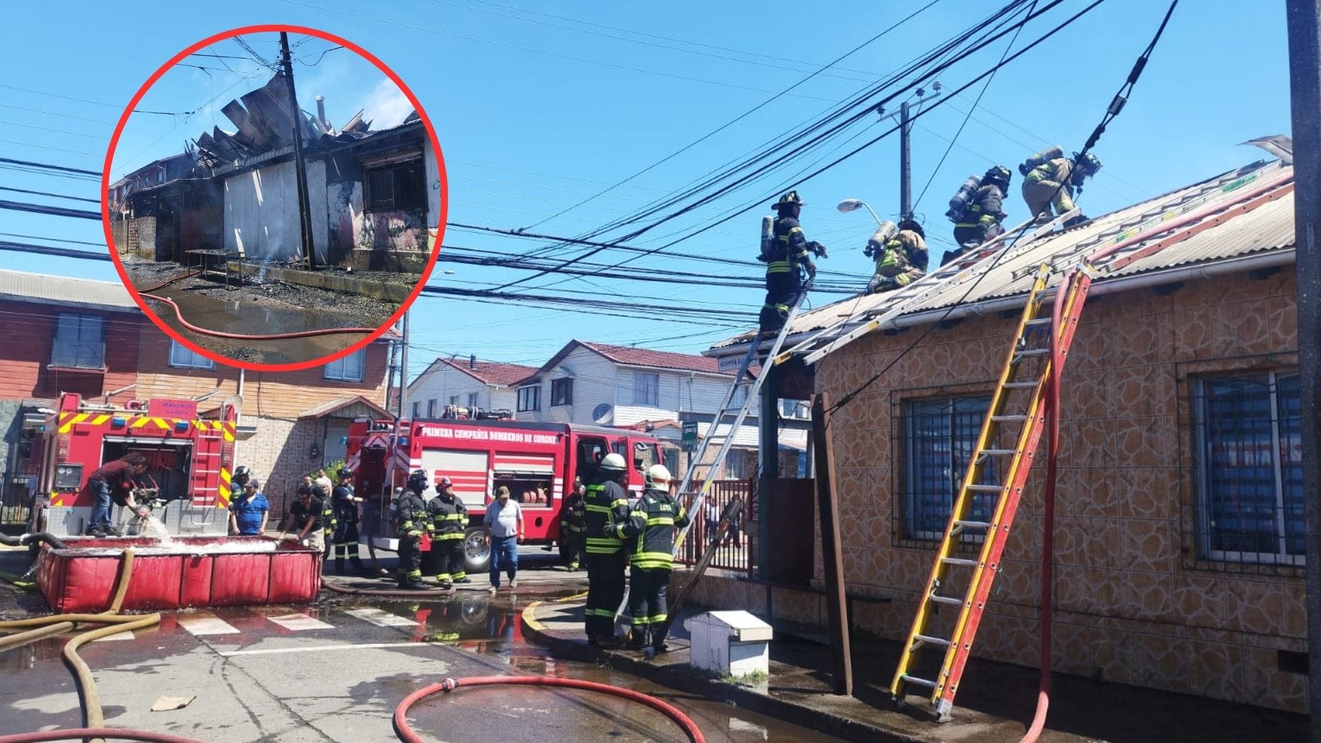 Incendio afecta a cuatro estructuras y deja múltiples heridos en Lota