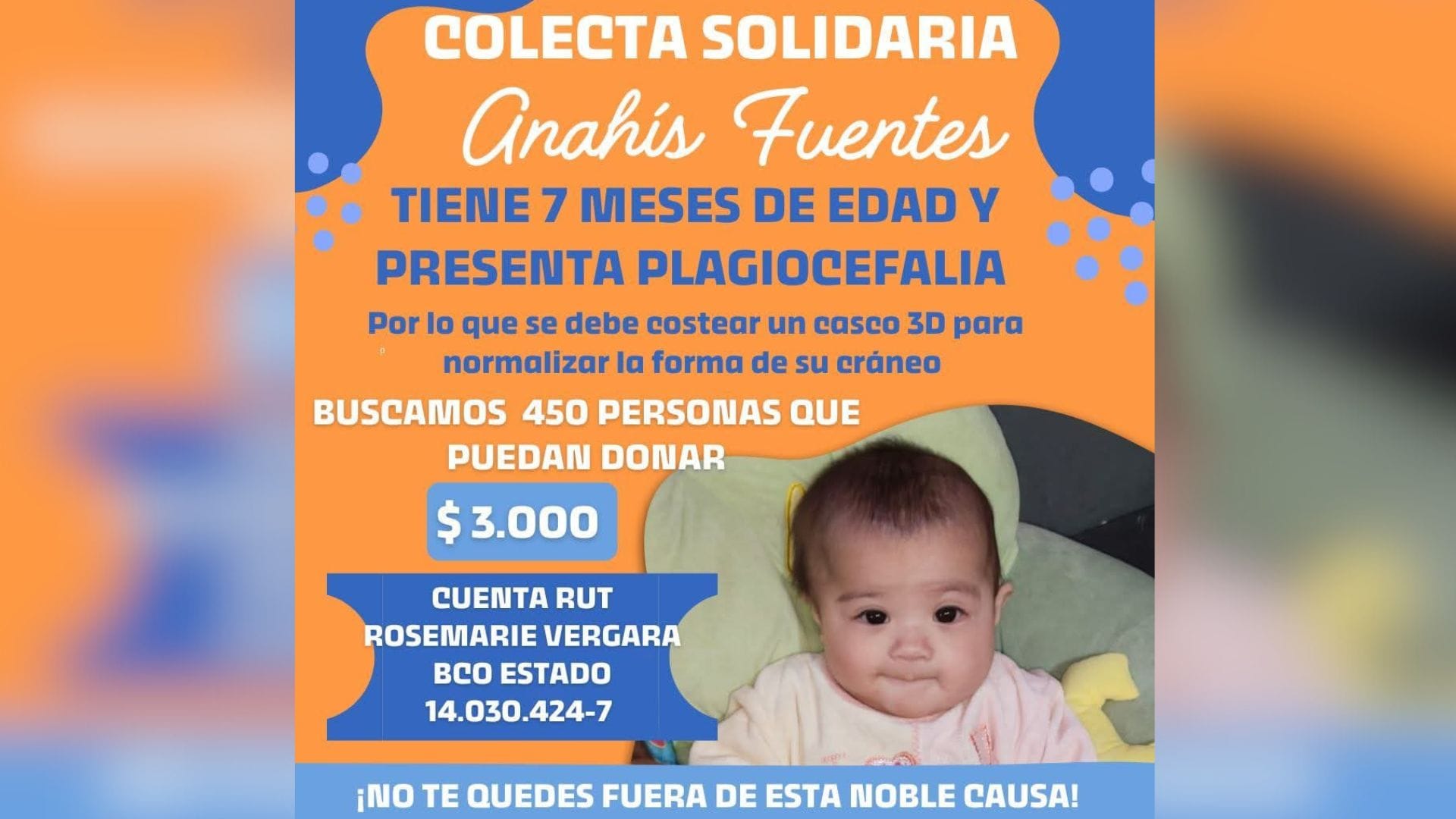 Bebé de Talcahuano necesita un casco 3D para el desarrollo de su cráneo: familia organiza campaña solidaria