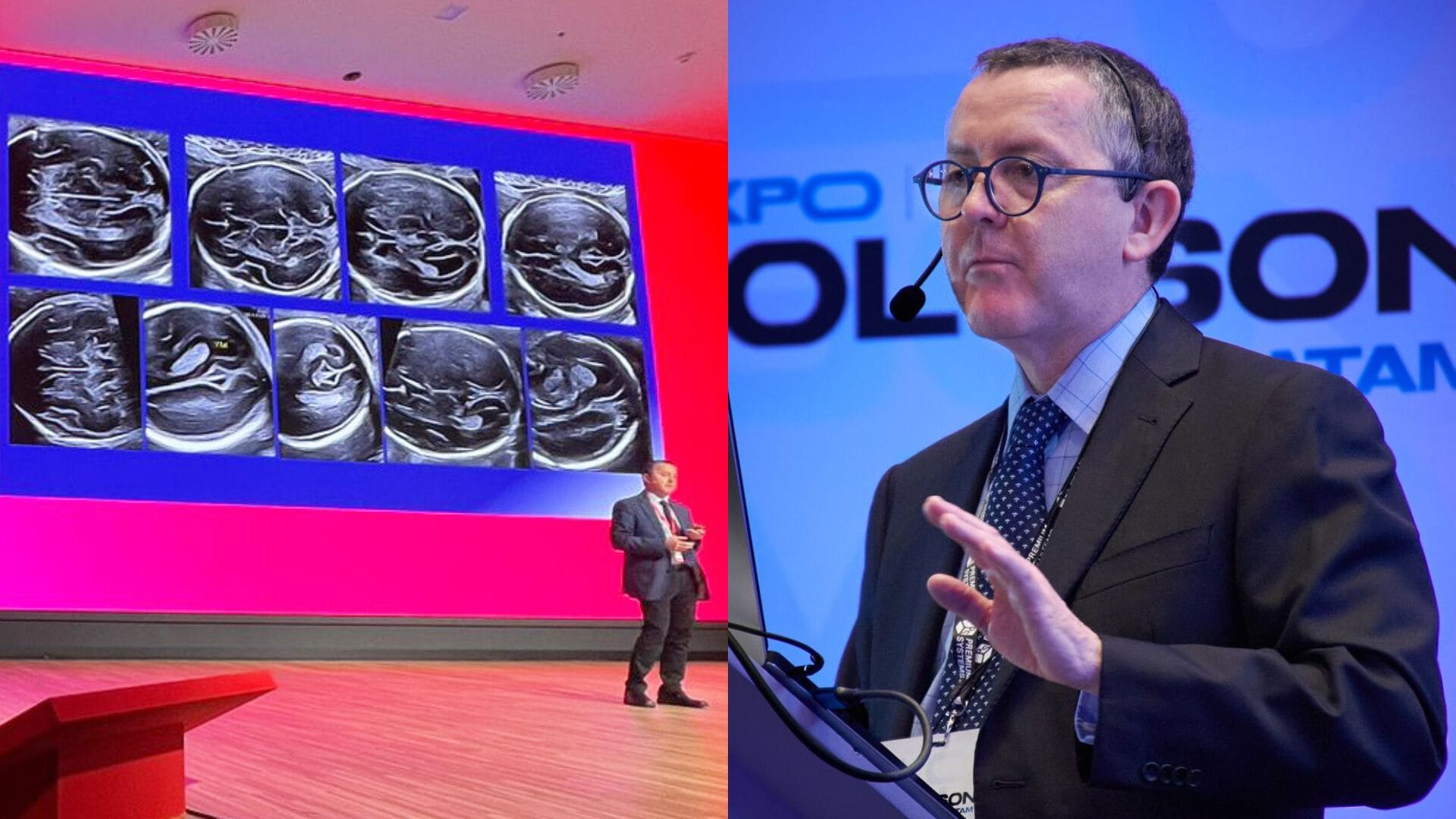 Doctor Fernando Viñals contribuye en innovación y avances en la ecografía prenatal