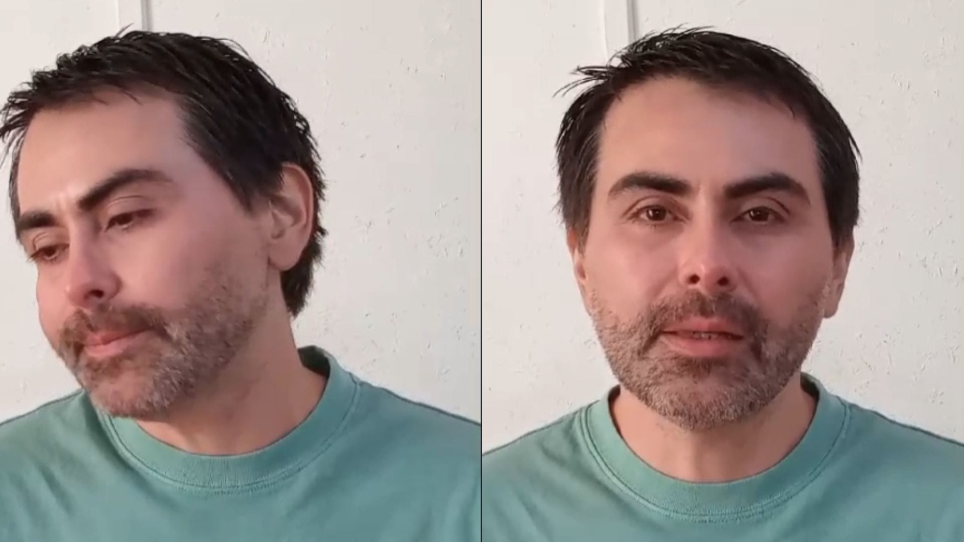 Penquista relata su experiencia con raro padecimiento que le provoca dolor constante: “Es una enfermedad catastrófica”