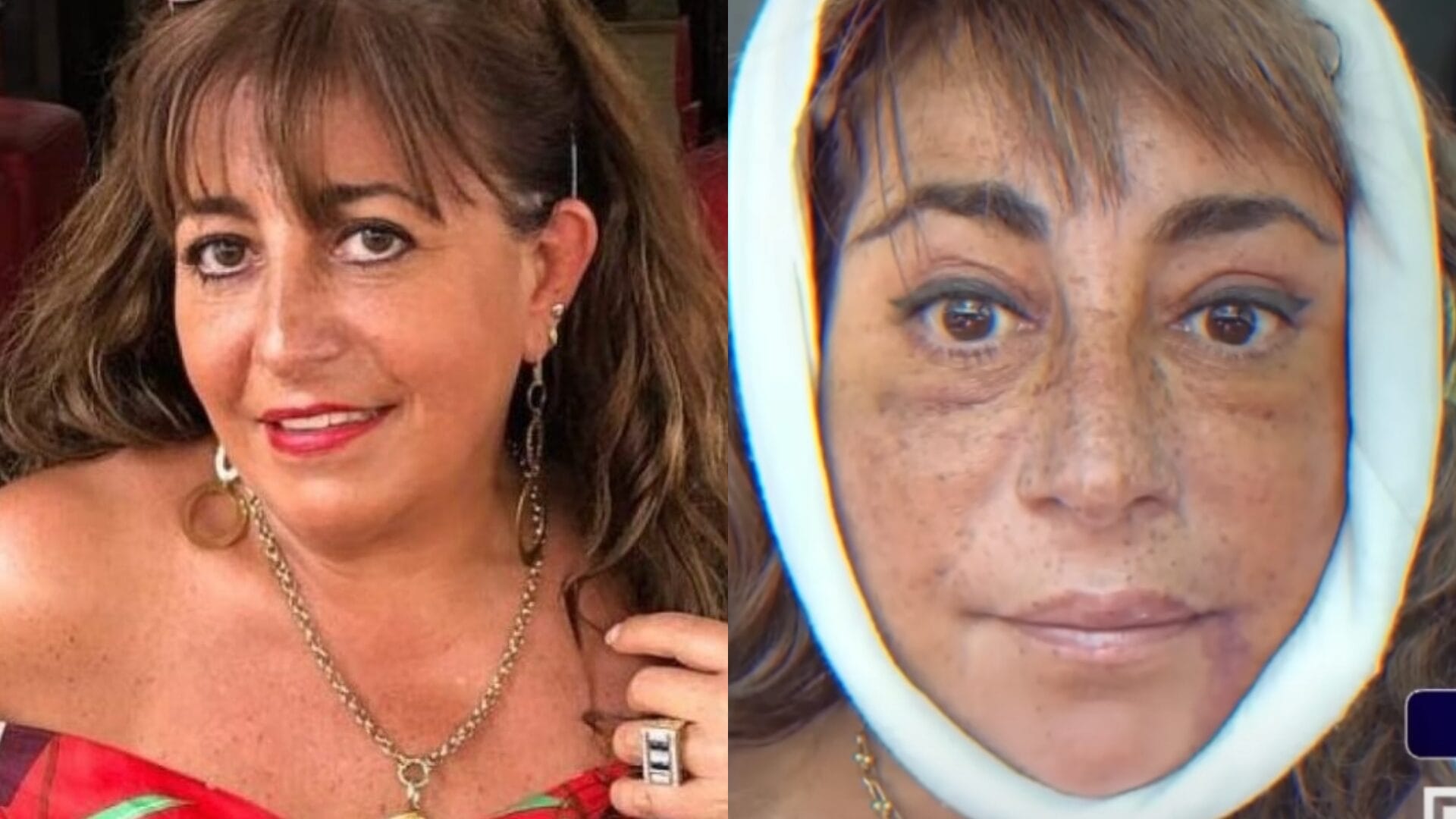 “Me sacó la cara y me la volvió a poner”: Helhue Sukni entregó detalles de la cirugía a la que se sometió