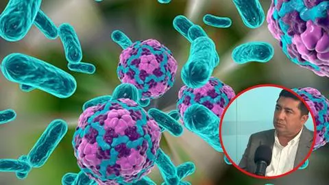 Características de la Hepatitis A: Alcalde de Talcahuano Eduardo Saavedra sigue internado y en recuperación