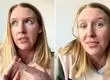 “Qué bueno que esto ocurrió en Chile”: Joven de Estados Unidos elogia el sistema de salud chileno tras acudir a urgencias