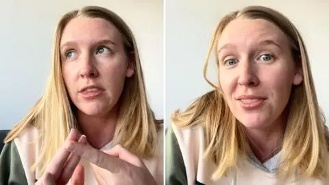 “Qué bueno que esto ocurrió en Chile”: Joven de Estados Unidos elogia el sistema de salud chileno tras acudir a urgencias