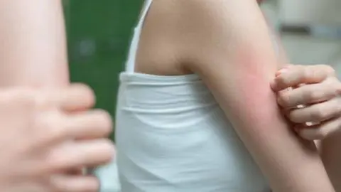 Arañas de rincón en verano: ¿Qué hacer ante una mordedura y cómo prevenirla?