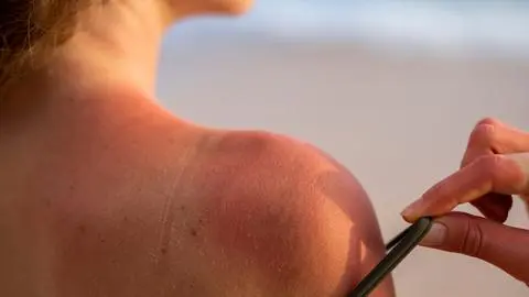 Temperaturas extremas: ¿Cómo evitar los golpes de calor?