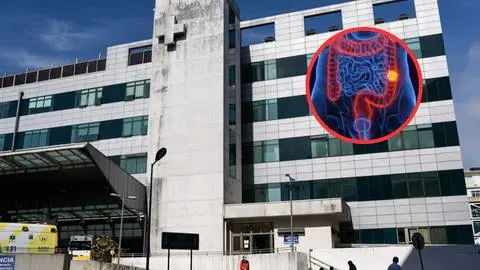 Cáncer colorrectal aumenta un 50% en la Región del Biobío en la última década