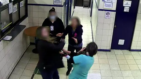 Funcionaria de salud sufre brutal golpe en Concepción: usuaria le dio un “mangazo” tras negarse a dar identidad