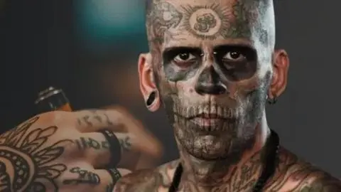 Así luce el hombre más tatuado de Brasil después de quitarse los dibujos de la cara