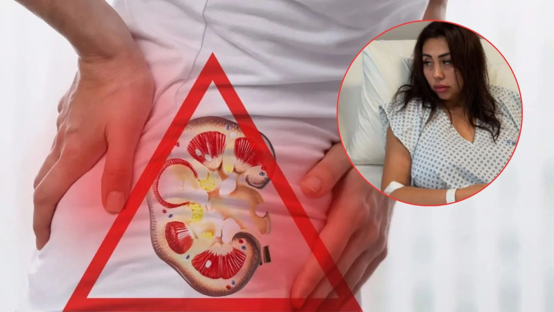 ¿Cómo saber si tengo Pielonefritis?: La enfermedad que puede ser mortal y mantiene hospitalizada a Naya Fácil