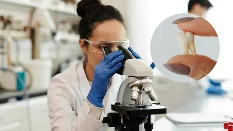 Científicos logran crear dientes en laboratorio usando hidrogeles personalizados