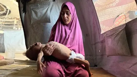 Un bebe y dos niños murieron por desnutrición en las últimas 24 horas en Gaza: Van 85 menores fallecidos por inanición