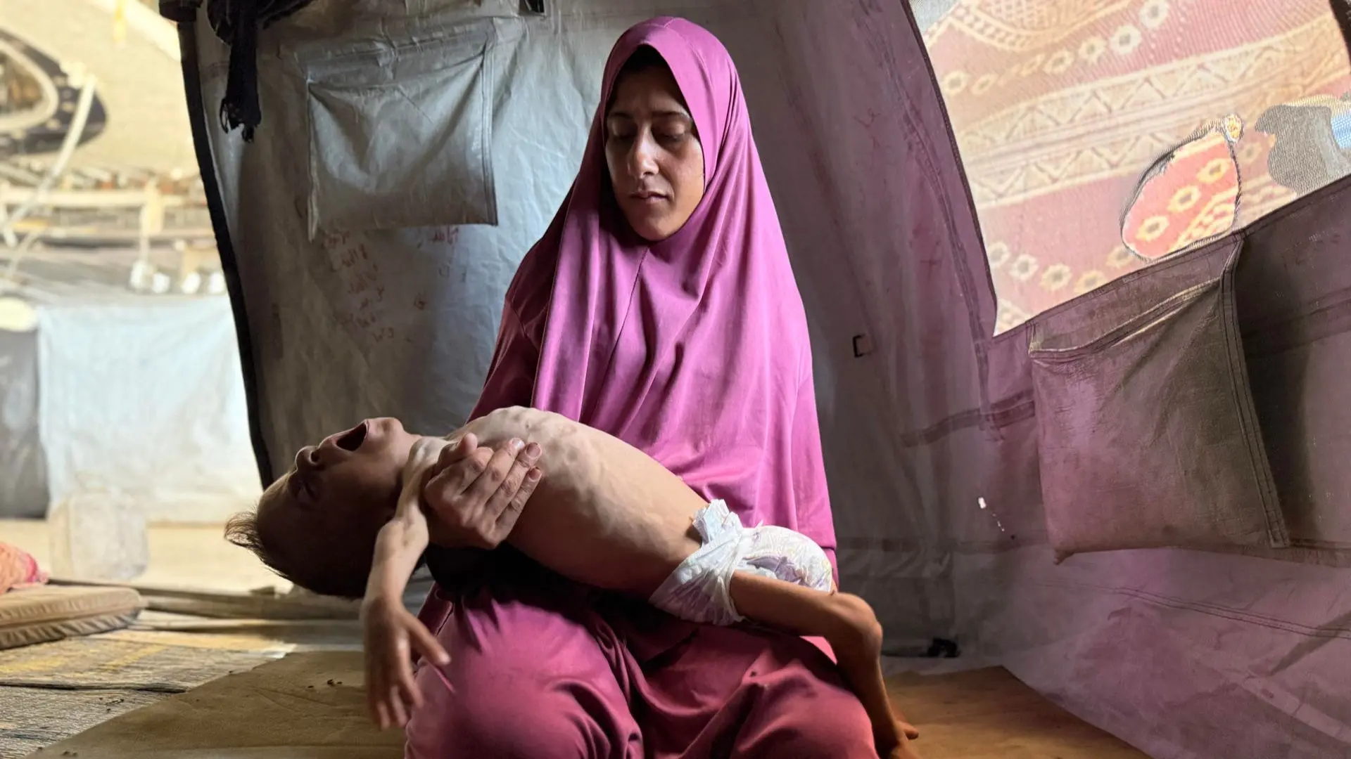 Un bebe y dos niños murieron por desnutrición en las últimas 24 horas en Gaza: Van 85 menores fallecidos por inanición