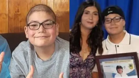 “He visto un cambio favorable”: El testimonio de joven que se sometió a inmunoterapia DEX para combatir la leucemia