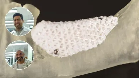 Avances del proyecto chileno que optimiza la adherencia de implantes dentales mediante impresión 3D