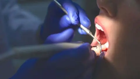 Condenan a dentista a indemnizar con $15 millones a paciente: perdió el sentido del gusto tras una extracción